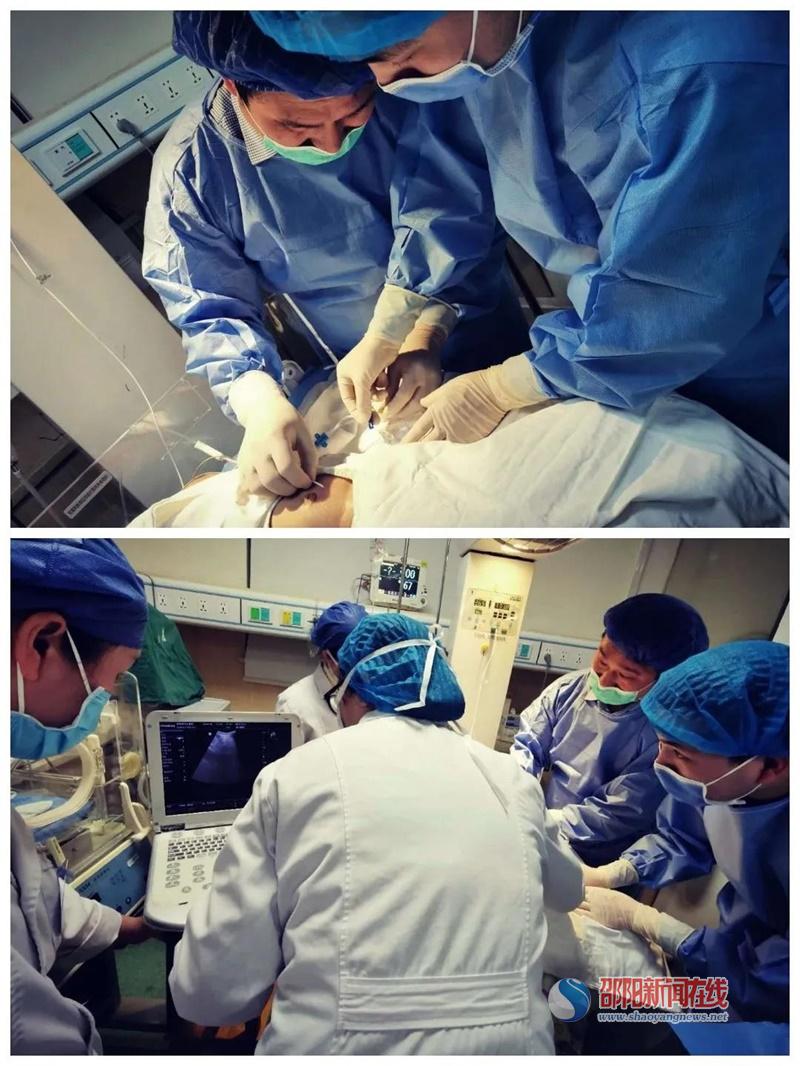 邵阳市中心医院成功开展全市首例新生儿腹膜透析