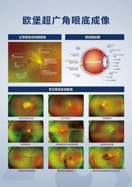 邵阳学院附属第一医院眼科引进欧堡超广角眼底成像系统