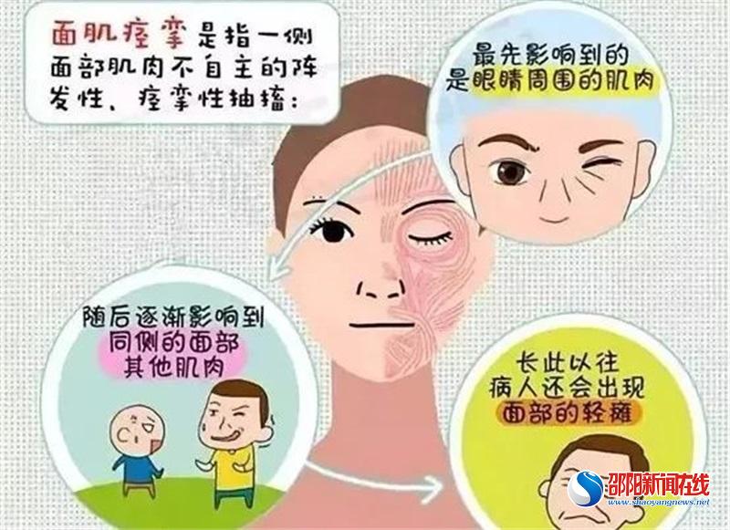 眼皮跳、口角抽、脖子歪怎么办？邵阳学院附属第一医院神经内科有法宝