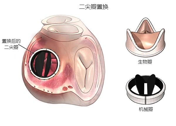 图片 4.png