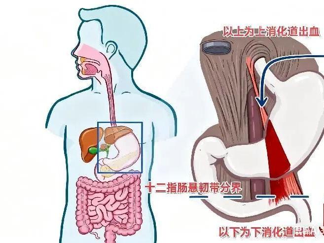 生死时速——邵阳市中心医院多学科协作挽救失血的生命